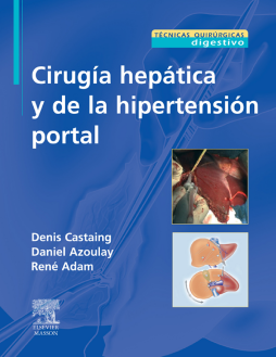 Cirugía hepática y de la hipertensión portal Cirugía hepática y de la hipertensión portal