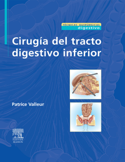 Cirugía del tracto digestivo inferior Cirugía del tracto digestivo inferior