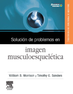Solución de problemas en imagen musculoesquelética Solución de problemas en imagen musculoesquelética