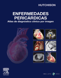 Enfermedades pericárdicas Enfermedades pericárdicas
