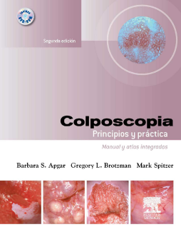 Colposcopia. Principios y práctica Colposcopia. Principios y práctica