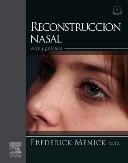 Reconstrucción nasal Reconstrucción nasal