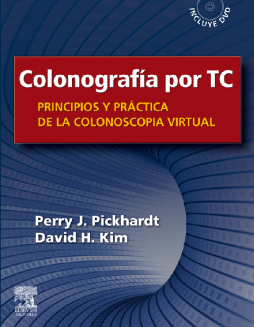 Colonografía por TC: Principios y práctica de la colonoscopia virtual Colonografía por TC: Principios y práctica de la colonoscopia virtual