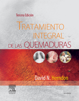 Tratamiento integral de las quemaduras Tratamiento integral de las quemaduras