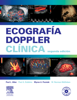 Ecografía Doppler clínica Ecografía Doppler clínica