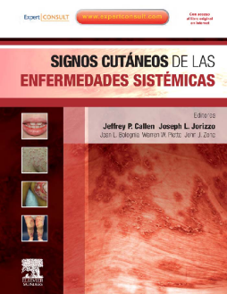 Signos cutáneos de las enfermedades sistémicas + ExpertConsult Signos cutáneos de las enfermedades sistémicas + ExpertConsult