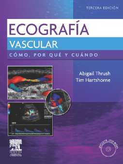 Ultrasonido vascular. Cómo, por qué y cuándo Ultrasonido vascular. Cómo, por qué y cuándo