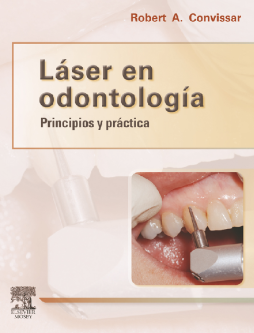Láser en odontología Láser en odontología