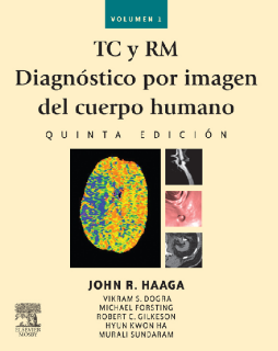 TC y RM. Diagnóstico por imagen del cuerpo humano TC y RM. Diagnóstico por imagen del cuerpo humano