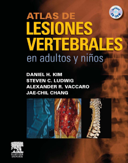 Atlas de lesiones vertebrales en adultos y niños Atlas de lesiones vertebrales en adultos y niños