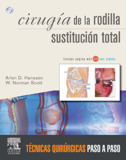 Cirugía la rodilla. Sustitución total + Web Cirugía la rodilla. Sustitución total + Web