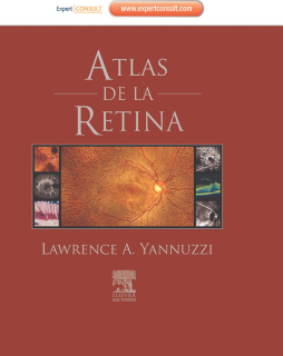 Atlas de la retina + ExpertConsult Atlas de la retina + ExpertConsult
