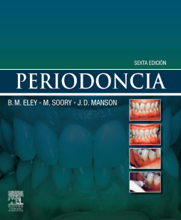 Periodoncia Periodoncia