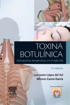 Toxina botulínica Toxina botulínica