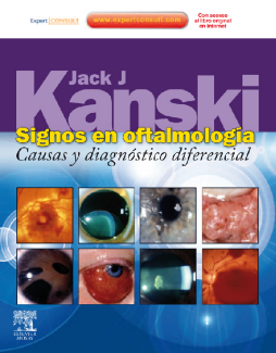 Signos en oftalmología + ExpertConsult