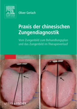 Praxis der chinesischen Zungendiagnostik Praxis der chinesischen Zungendiagnostik