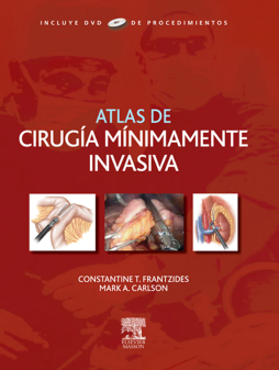 Atlas de cirugía mínimamente invasiva Atlas de cirugía mínimamente invasiva