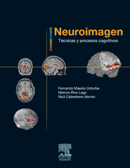 Neuroimagen. Técnicas y procesos cognitivos Neuroimagen. Técnicas y procesos cognitivos