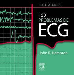 150 problemas de ECG 150 problemas de ECG
