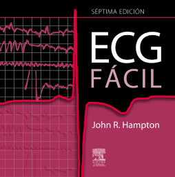 ECG fácil ECG fácil