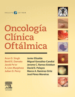 Oncología clínica oftálmica Oncología clínica oftálmica
