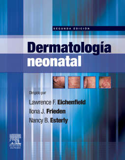 Dermatología neonatal Dermatología neonatal