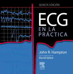 ECG en la práctica ECG en la práctica