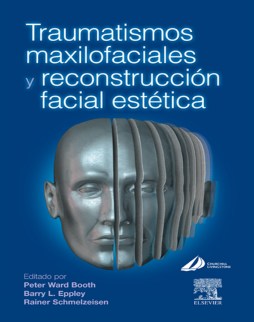 Traumatismos maxilofaciales y reconstrucción facial estética Traumatismos maxilofaciales y reconstrucción facial estética
