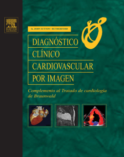 Diagnóstico clínico cardiovascular por imagen Diagnóstico clínico cardiovascular por imagen