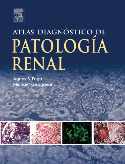 Atlas diagnóstico de patología renal Atlas diagnóstico de patología renal