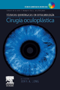 Cirugía oculoplástica Cirugía oculoplástica