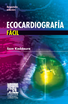 Ecocardiografía fácil Ecocardiografía fácil