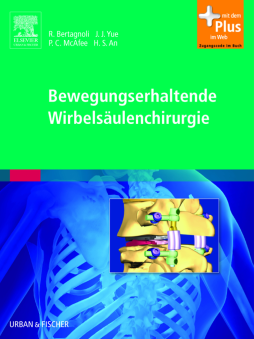 Bewegungserhaltende Wirbelsäulenchirurgie Bewegungserhaltende Wirbelsäulenchirurgie