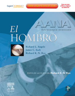AANA. Artroscopia avanzada. El hombro + ExpertConsult AANA. Artroscopia avanzada. El hombro + ExpertConsult