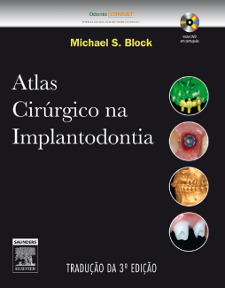 Atlas Cirúrgico na Implantodontia Atlas Cirúrgico na Implantodontia