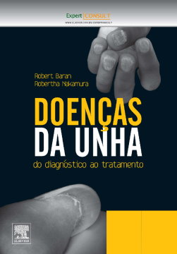 Doenças Da Unha Doenças Da Unha