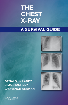 The Chest X-Ray: A Survival Guide E-Book