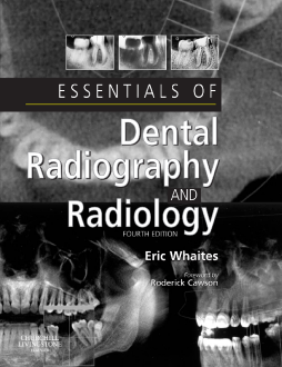 Essentials of Dental Radiography and Radiology E-Book Essentials of Dental Radiography and Radiology E-Book