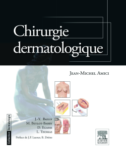 Chirurgie dermatologique Chirurgie dermatologique