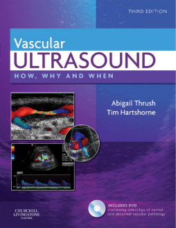 Vascular Ultrasound E-Book Vascular Ultrasound E-Book