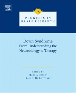 Down Syndrome: From Understanding the Neurobiology to Therapy Down Syndrome: From Understanding the Neurobiology to Therapy