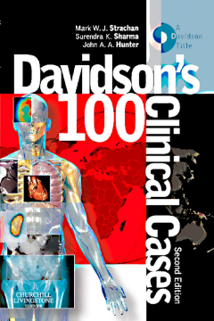Davidson's 100 Clinical Cases E-Book Davidson's 100 Clinical Cases E-Book