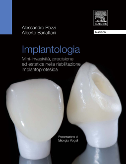 Implantologia Implantologia
