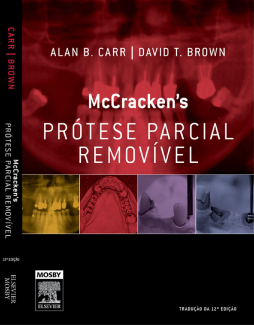 Mccracken Prótese Parcial Removível Mccracken Prótese Parcial Removível