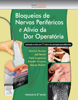 Bloqueios De Nervos Periféricos E Alívio Da Dor Operatória Bloqueios De Nervos Periféricos E Alívio Da Dor Operatória