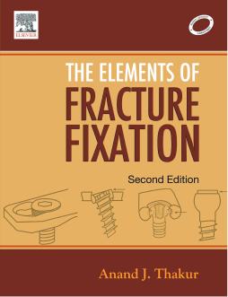 Elements of Fracture Fixation - E-Book Elements of Fracture Fixation - E-Book