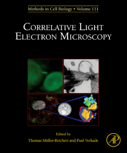 Correlative Light and Electron MIcroscopy Correlative Light and Electron MIcroscopy