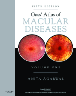 Gass' Atlas of Macular Diseases E-Book Gass' Atlas of Macular Diseases E-Book