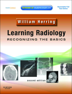 Learning Radiology: Recognizing the Basics E-Book Learning Radiology: Recognizing the Basics E-Book
