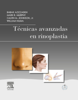 Técnicas avanzadas en rinoplastia Técnicas avanzadas en rinoplastia